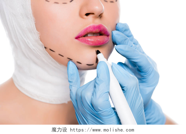 白色背景上在女士脸上做标记的整形医生穿着蓝色乳胶手套的整形外科医生的裁剪视图, 在妇女附近拿着标记笔, 脸上有痕迹, 在白色上被隔离 